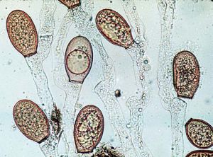 Chytridiomycetes1.jpg